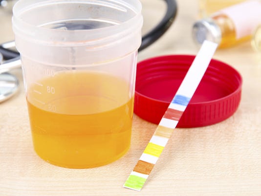 what do urine sample test for